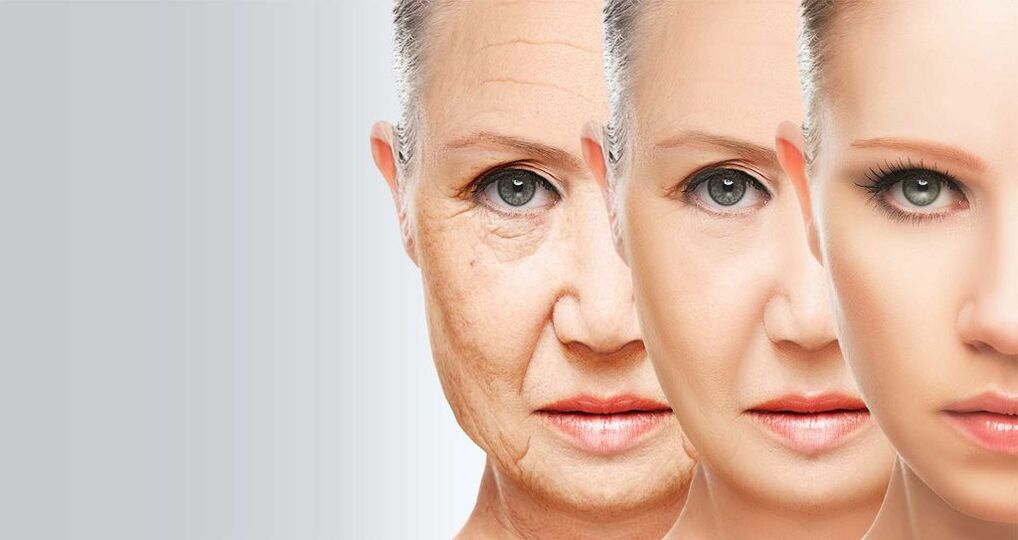Подмлађивање коже лица ласерском технологијом